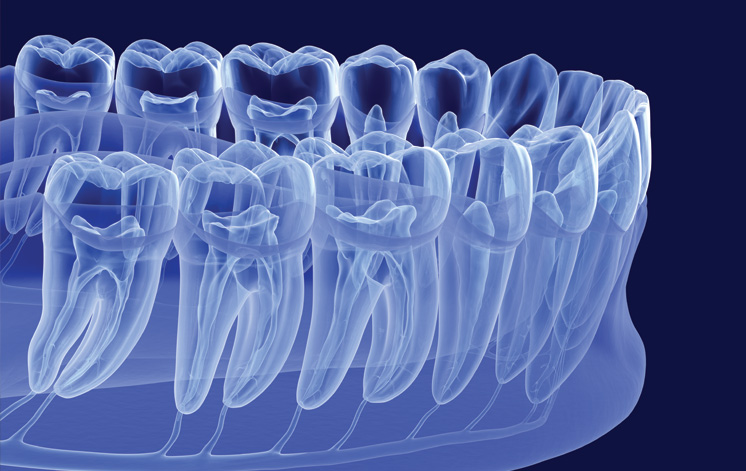 Treatment - Centre Point Dental