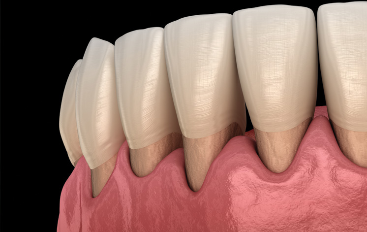 Treatment - Centre Point Dental